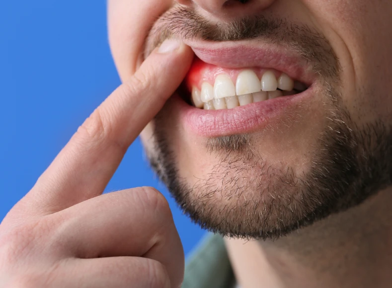 Periodontia