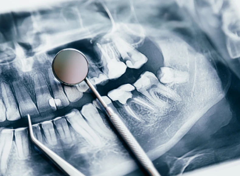 radiografias digitais