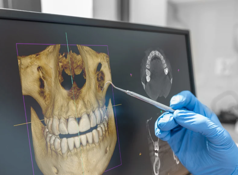 tomografia odontológica