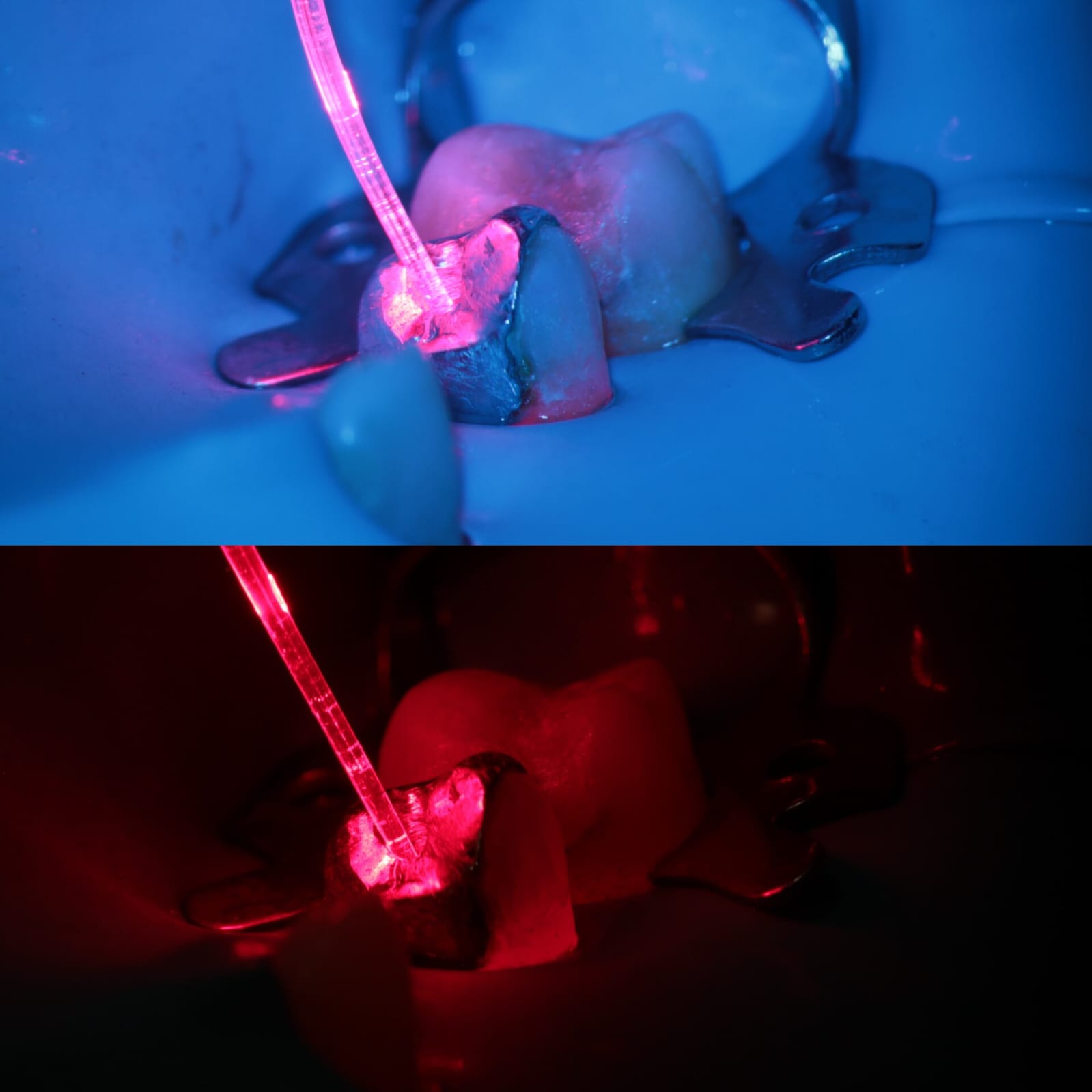 Laserterapia: como essa tecnologia auxilia na odontologia moderna